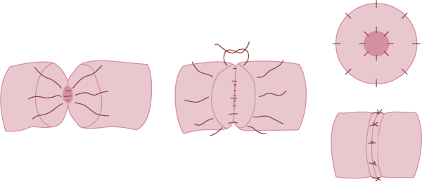 ���� �������� ���