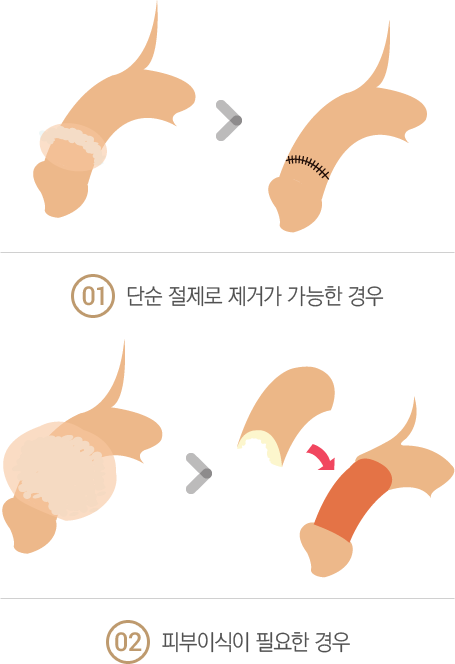 �̹������ż�