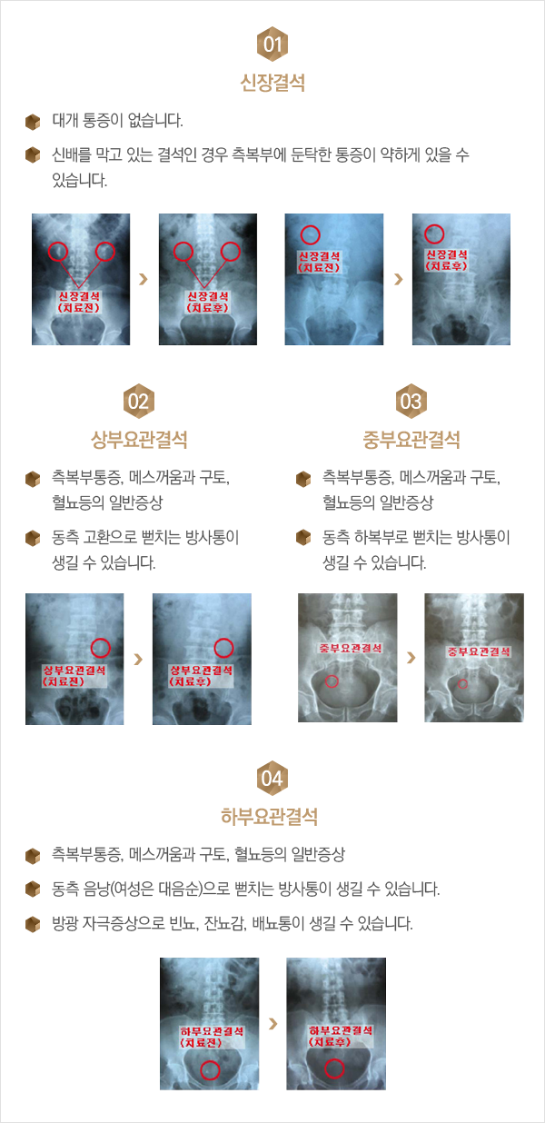 ��ΰἮ�� ����