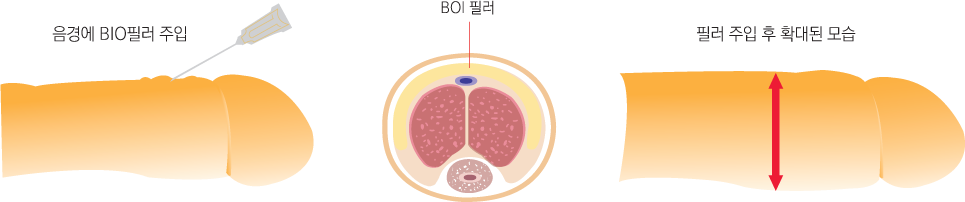 ������ �ʷ�����Ȯ��