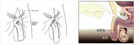 �߱�� ���̿��� : �鸷������
