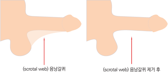 �����������ż�