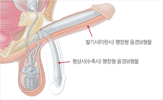 ��â�� ������