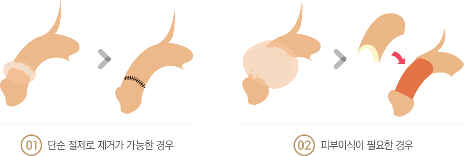 �̹������ż�