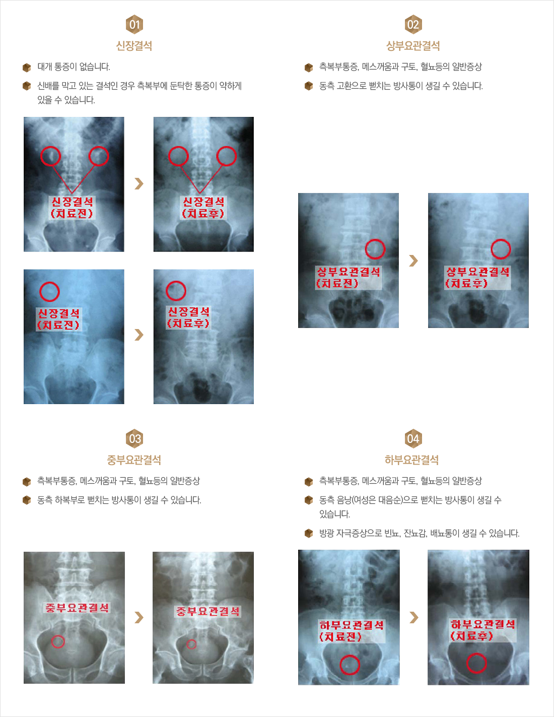 ��ΰἮ�� ����